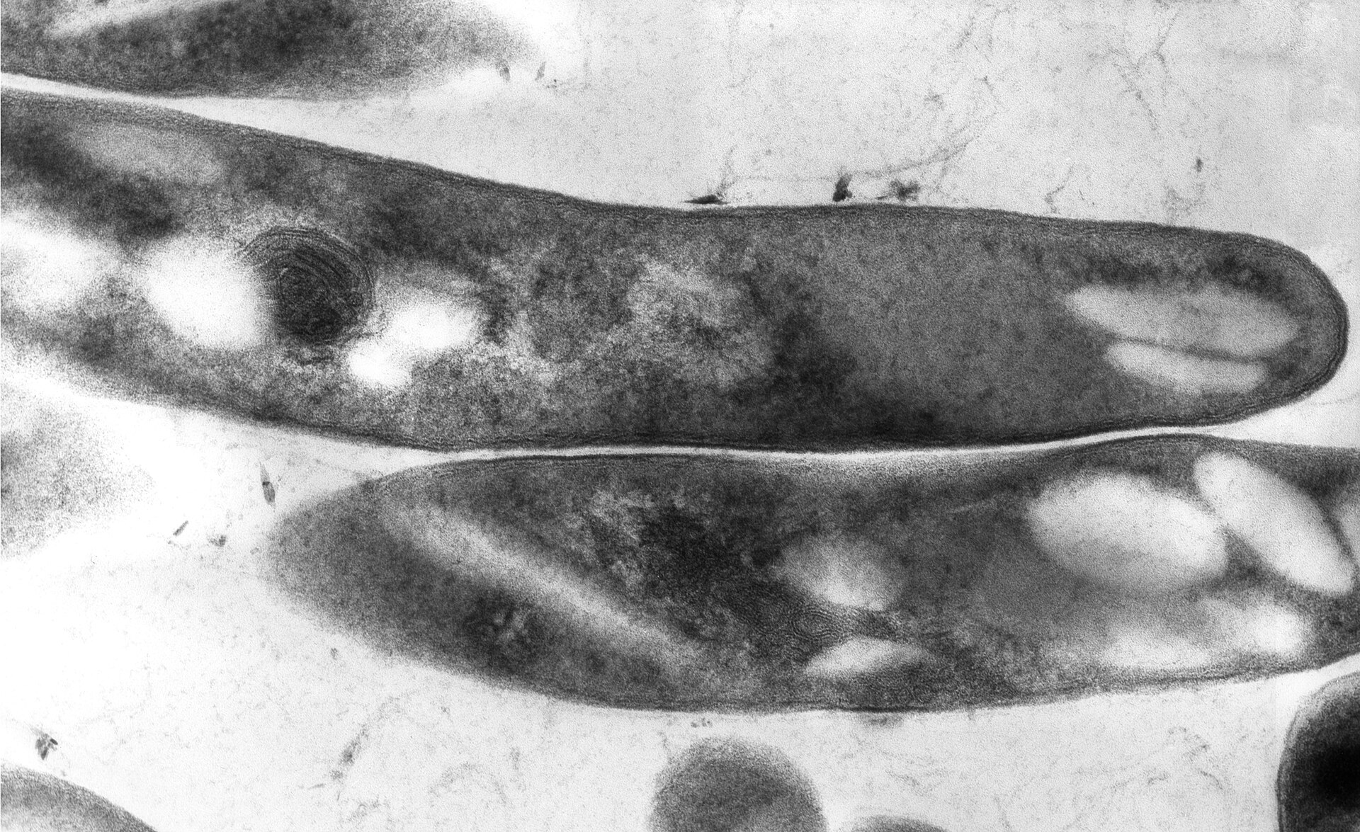 Mycobacterium tuberculosis bacilli under microscopy